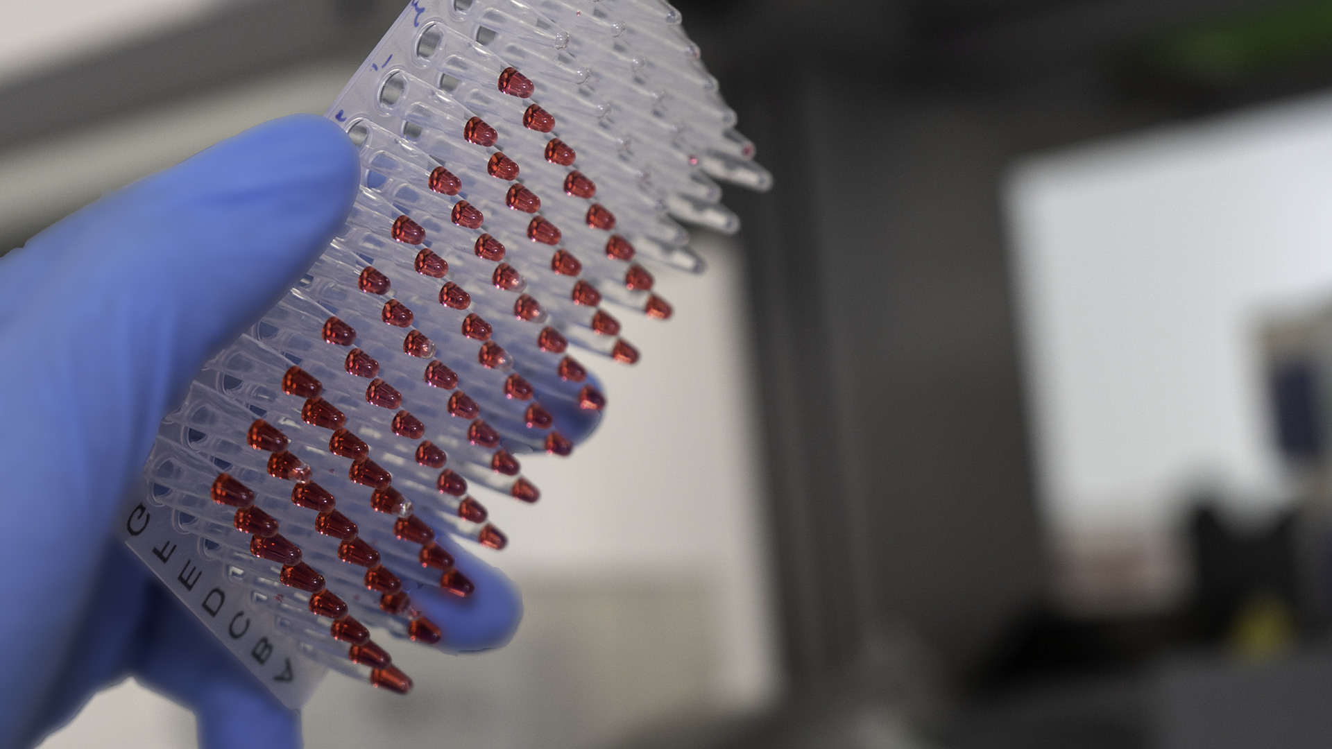 VLC-Bioclínic selecciona 8 proyectos conjuntos de INCLIVA y la UV de I+D+i en el ámbito de la salud VLC-Bioclínic selecciona 8 proyectos conjuntos de INCLIVA y la UV de I+D+i en el ámbito de la salud